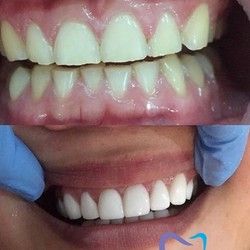 Put ka boljem zdravlju i lepšem izgledu zuba - Stomatološka ordinacija US Dental Kragujevac
