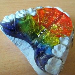 Decije proteze za zube - Mobilni ortodontski aparati