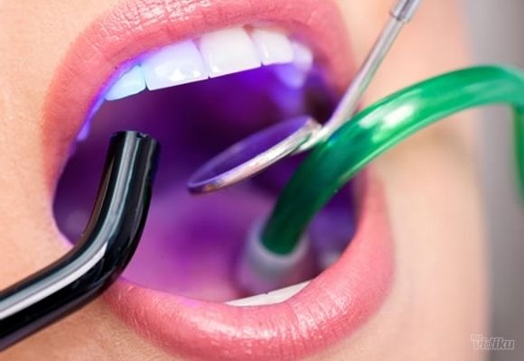 Popravka i lecenje zuba /Plombiranje