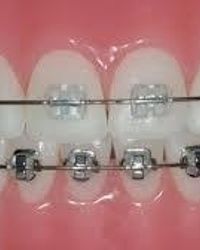 Ortodontski aparat