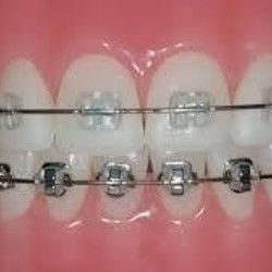 Ortodontski aparat