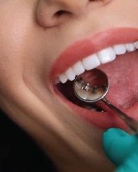 Protetika implantati ortodoncija Estetska stomatologija