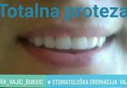 Zubne proteze Beograd