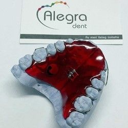 Mobilne proteze za ispravljanje zuba za odrasle