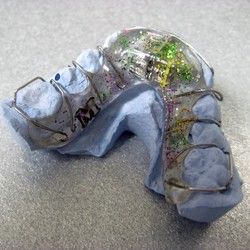 Mobilne proteze za ispravljanje zuba