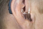 Gain Super Power BTE 2&3 zaušni slušni aparati za najteža oštećenja sluha