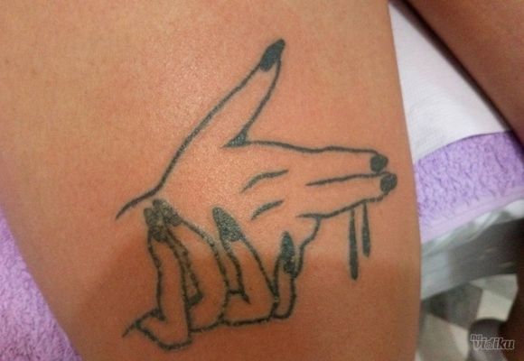 Skidanje tetovaza