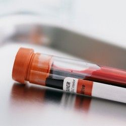 Analiza krvi - U-alfa amilaza - Mikrobiološka Laboratorija Marković