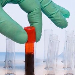 Analiza krvi - Fibrinogen - Mikrobiološka Laboratorija Marković