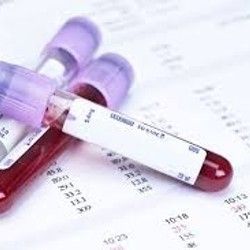 Analiza krvi - Proteini - Mikrobiološka Laboratorija Marković