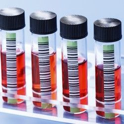 Analiza krvi - Kalijum - Mikrobiološka Laboratorija Marković