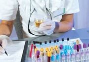 Analiza urina - specifična gustina mokraće - Laboratorija Analiza 3