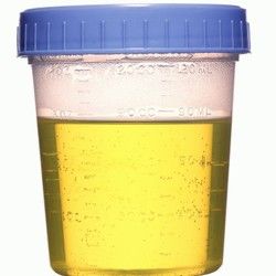 Analiza urina - proteini u mokraći - BioDiagnostica Laboratorija
