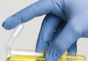Analiza urina - Glukoza u mokraći - BioDiagnostica Laboratorija