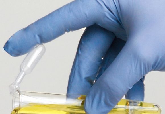 Analiza urina - Glukoza u mokraći - BioDiagnostica Laboratorija