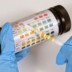 Analiza urina - Aceton u mokraći - BioDiagnostica Laboratorija