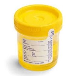 Analiza urina - Nitriti u mokraći - BioDiagnostica Laboratorija