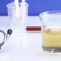 Analiza urina - Eritrociti sveži u mokraći - BioDiagnostica Laboratorija