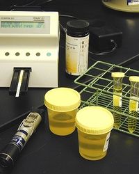 Analiza urina - Eritrociti bledi u mokraći - BioDiagnostica Laboratorija