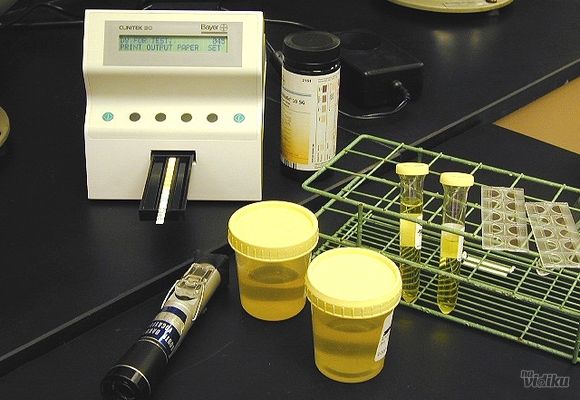 Analiza urina - Eritrociti bledi u mokraći - BioDiagnostica Laboratorija