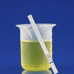 Analiza urina - Kristali mokraćne kiseline -Aqualab Plus Laboratorije