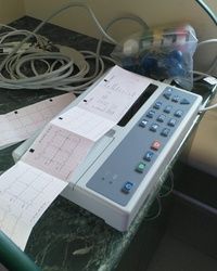 EKG za bebe Sabac