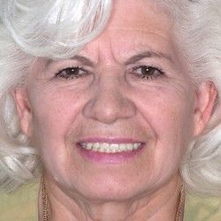 Estetska stomatologija Blok 63