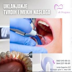 Skidanje kamenca sa zuba Blok 45