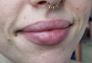 Pirsing na nosu alka sa bodljama