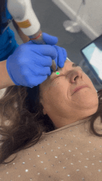 SmoothEye tretman Zvezdara