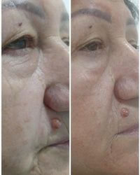 Antiage tretmani Mirijevo