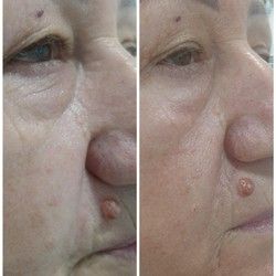 Antiage tretmani Mirijevo