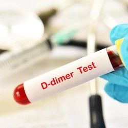 Уровень D-димера