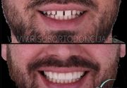 Ortodoncija & Protetika