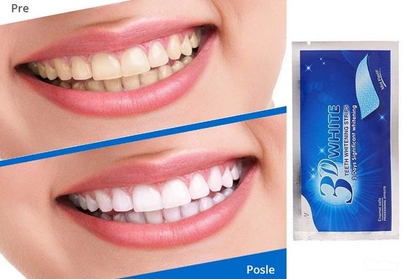 trake-za-izbeljivanje-zuba-3d-white-110671.jpg