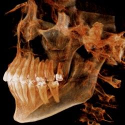 3D snimanje zuba Vozdovac