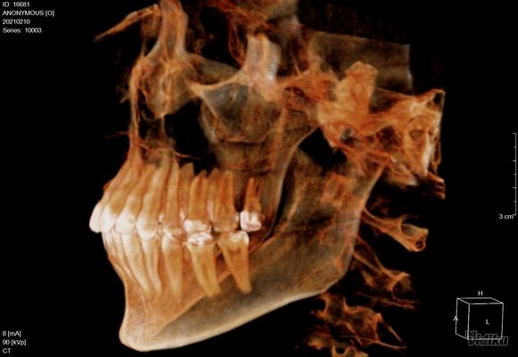 3D snimanje zuba Vozdovac