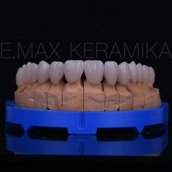 Ortodontska terapija