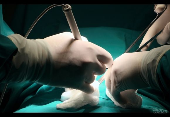 Laserska operacija hemoroida