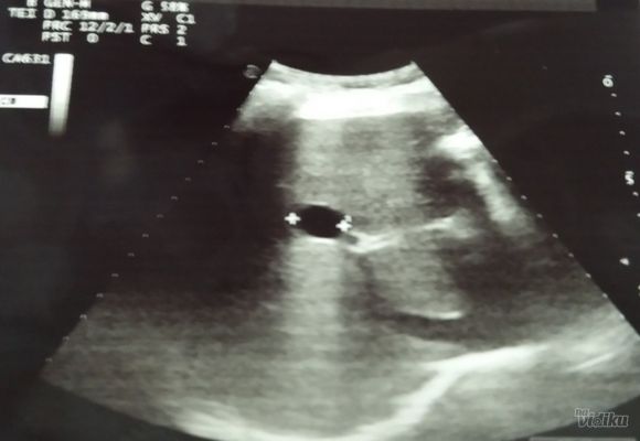 Ultrazvuk abdomena, prostate i mokraćnih puteva