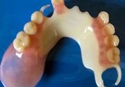Bredent proteza za zube Pancevo