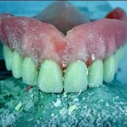 Proteza za zube Banovo brdo