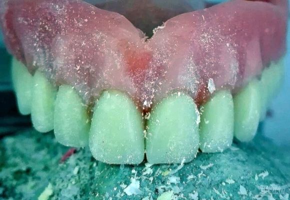 proteza-za-zube-banovo-brdo-f673d8.jpg