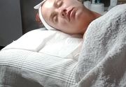 Ultrazvucno ciscenje lica Cukarica