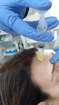 Mezoterapija Kragujevac 