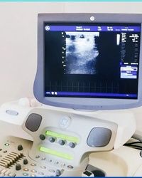 ULTRA ZVUK SRCA