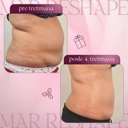 Kako se osloboditi tvrdokornih masnih naslaga?