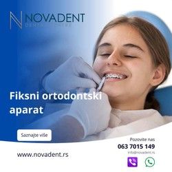 Fiksne proteze: Sve sto treba da znate