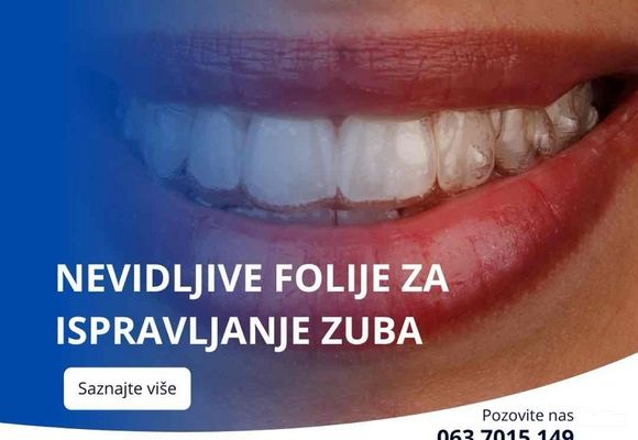 Nevidljive folije za ispravljanje zuba : Sve sto treba da znate