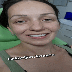 Cirkonijum keramika